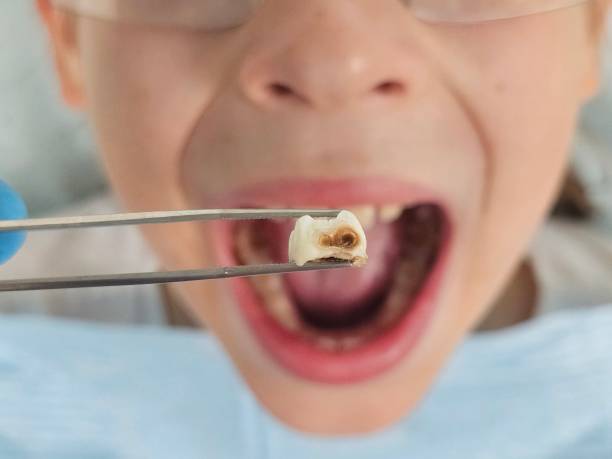 Best Urgent Dental Care for Toothache in Henryetta, OK